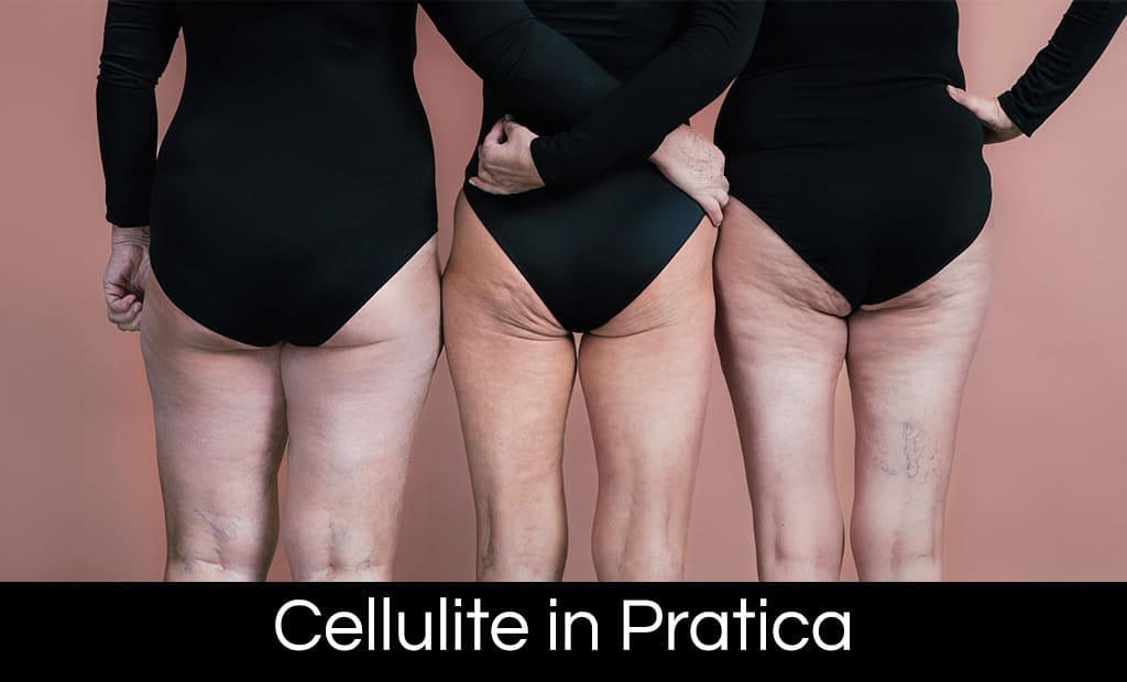 COPERTINE MASTERCLASS_CELLULITE IN PRATICA