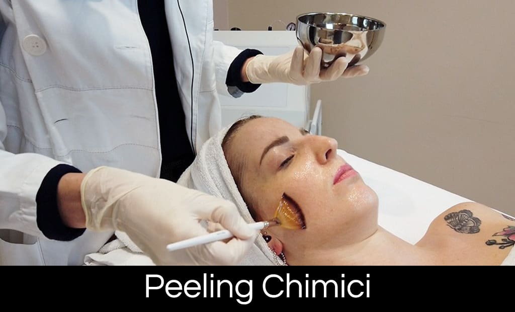 COPERTINE MASTERCLASS_PEELING CHIMICI